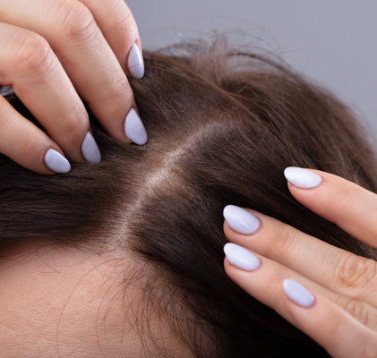 Comment éviter la perte de cheveux et les fortifier : conseils et astuces